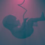 Fetal anomali nedir?
